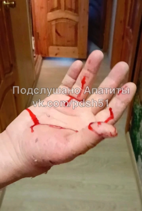 Хаски набросилась на жителя Апатитов Хаски набросилась на жителя Апатитов