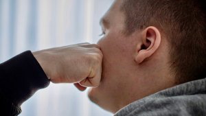 В Кандалакше попытка разнять драку у пивбара закончилась для северянина сломанной челюстью