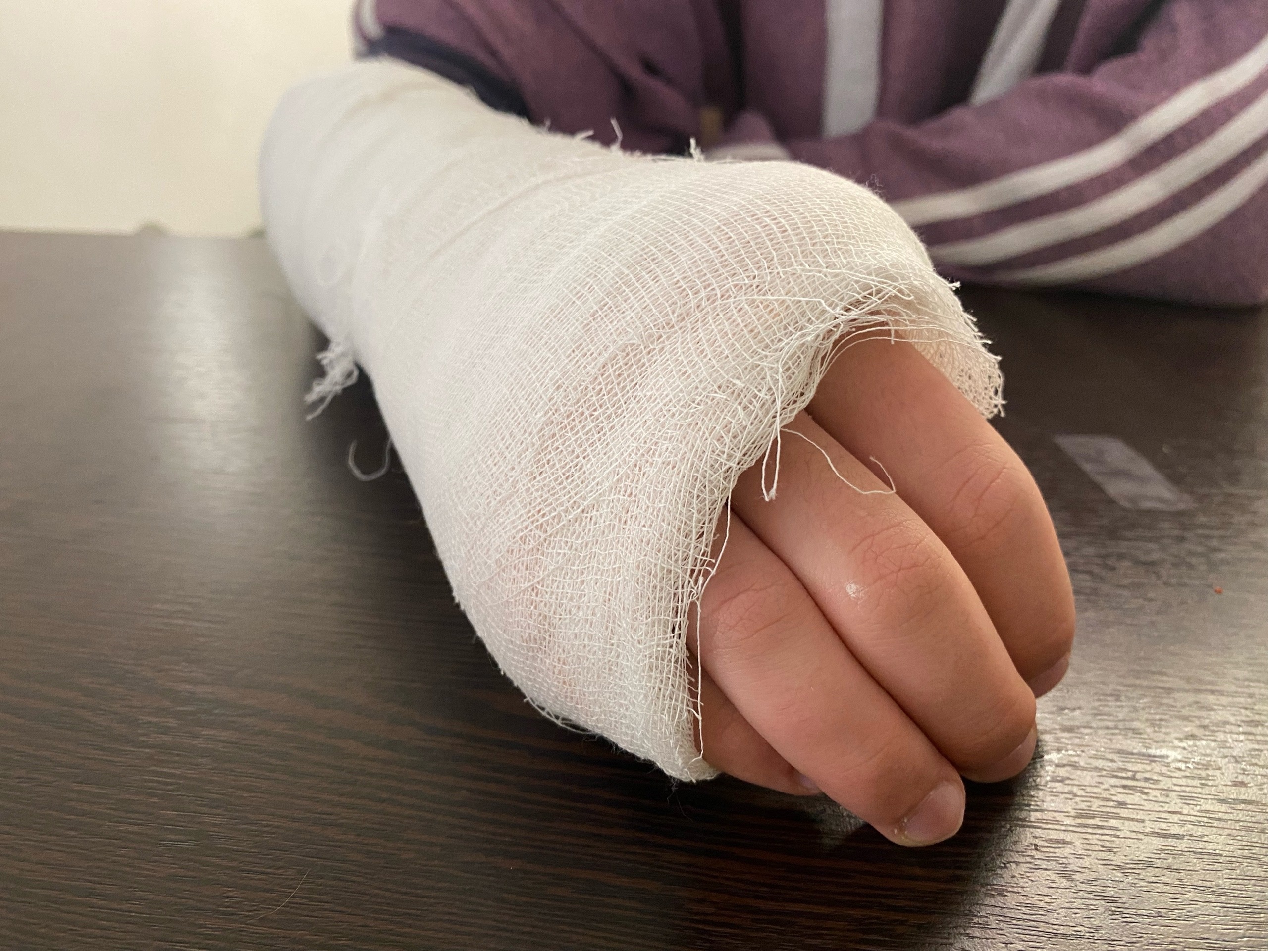 В Апатитах мужчина брызнул перцовым баллончиком в лицо соседке, та сломала ему палец