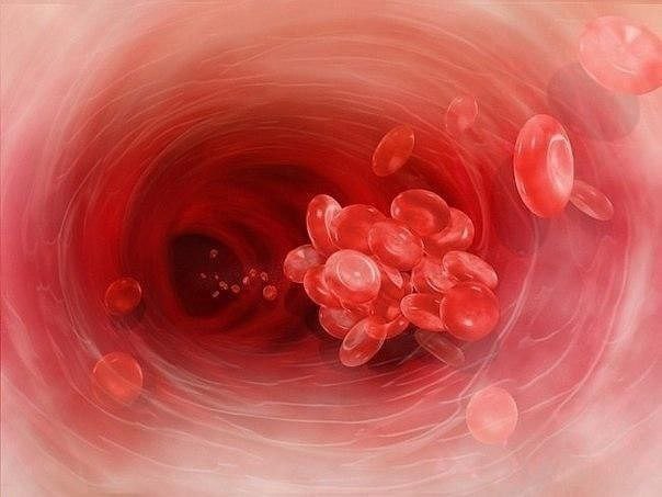 С заботой о себе: как предотвратить сгущение крови — это не сложно